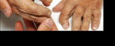 Assessing patient experiences with rheumatoid arthritis care