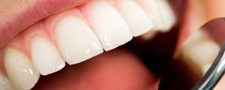 Mondhygiënist kan meer betekenen