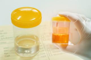 Nivel: One in twelve adults has diagnosis of chronic kidney disease 